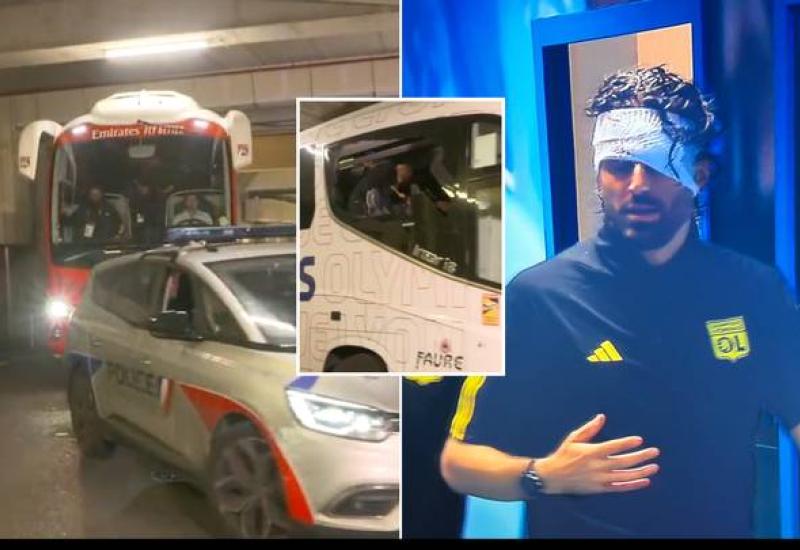 Navijači Marseilla kamenovali autobus Lyona, trener Grosso pogođen u glavu 